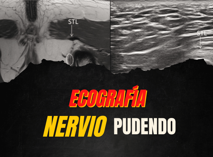 nervio-pudendo-y-ecografia